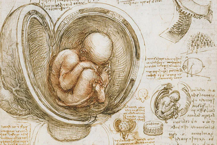 Fetus in Fetu: The Surprising Case of a Twin Inside a Twin